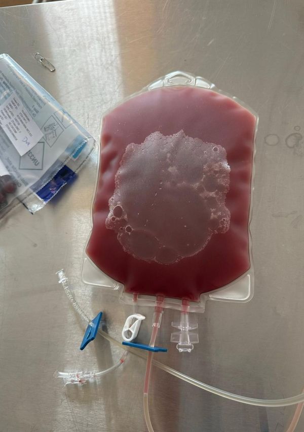 Hoe een stamceldonor een leven kan redden 4
